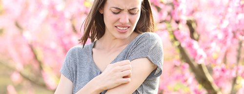 Какво помага при ухапване от различни насекоми? Научете тук!